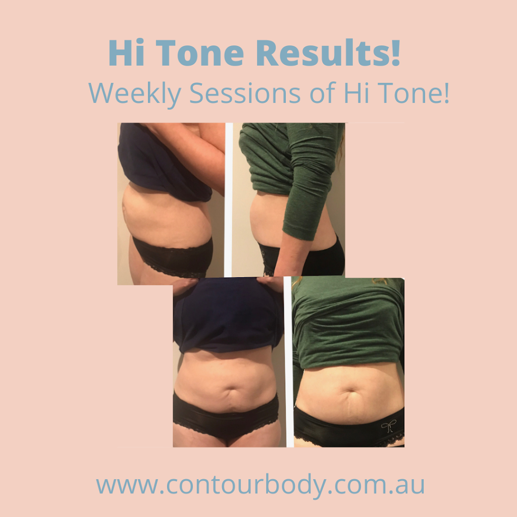 Contour Body Malvern | 413 Waverley Rd, Malvern East VIC 3145, Australia | Phone: 0428 942 075