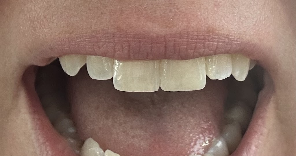 West Gippsland Dental | 54 Main S Rd, Drouin VIC 3818, Australia | Phone: (03) 5644 1323