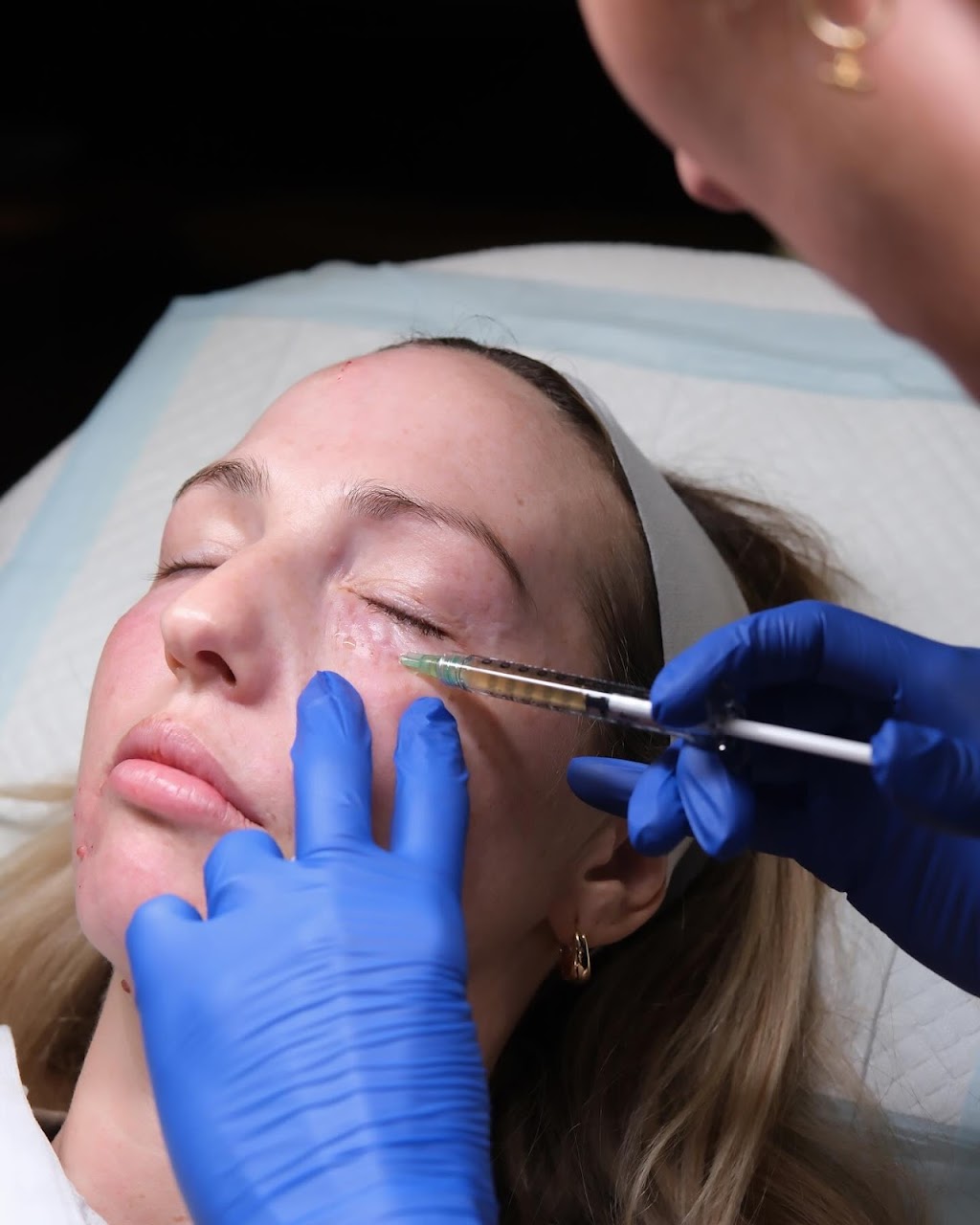 Vae Medical Aesthetics | 16 Old Pacific Hwy, Newrybar NSW 2479, Australia | Phone: 0422 639 013