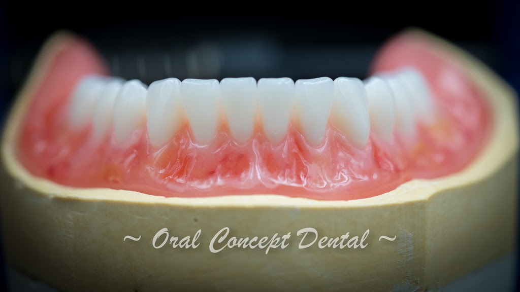 Oral Concept Dental Laboratory | dentist | 25 Whiteside St, Cloverdale WA 6105, Australia | 0892774202 OR +61 8 9277 4202
