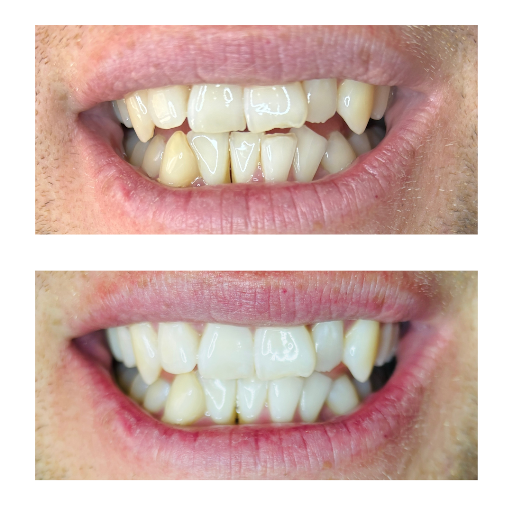 The Whitening Room | MacDougall Rd, Golden Gully VIC 3555, Australia | Phone: 0426 284 861