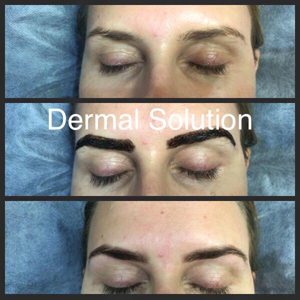 Dermal Solution Skin & Beauty Clinic | hair care | 279 Napier St, Strathmore VIC 3041, Australia | 0393798585 OR +61 3 9379 8585