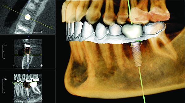 Swan Hill Smiles | dentist | 259 Beveridge St, Swan Hill VIC 3585, Australia | 0350331115 OR +61 3 5033 1115