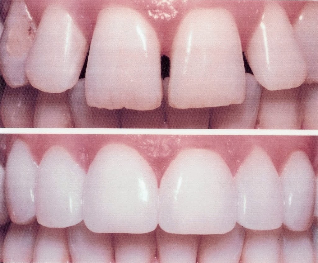 Greenslopes Dental | dentist | 5/582 Logan Rd, Greenslopes QLD 4120, Australia | 0733943399 OR +61 7 3394 3399