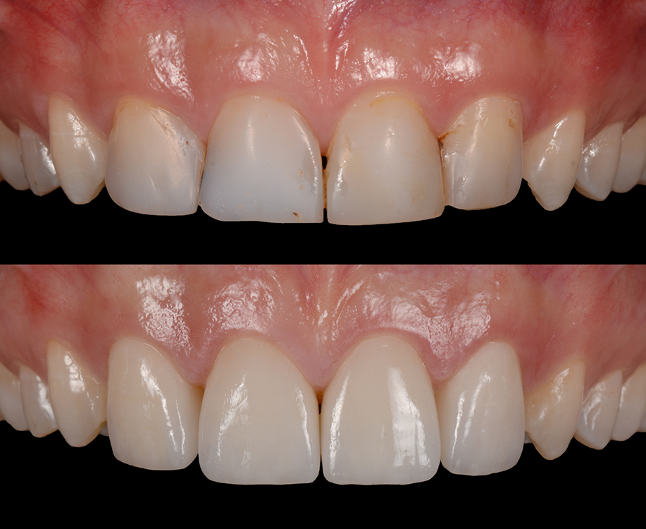 Dr Chee Chang | Prosthodontist | dentist | 1568 Malvern Rd, Glen Iris VIC 3146, Australia | 0398854591 OR +61 3 9885 4591