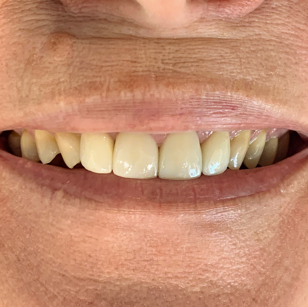 Healthy Smiles Dental Group | doctor | 152 Canterbury Rd, Blackburn South VIC 3130, Australia | 0398772035 OR +61 3 9877 2035