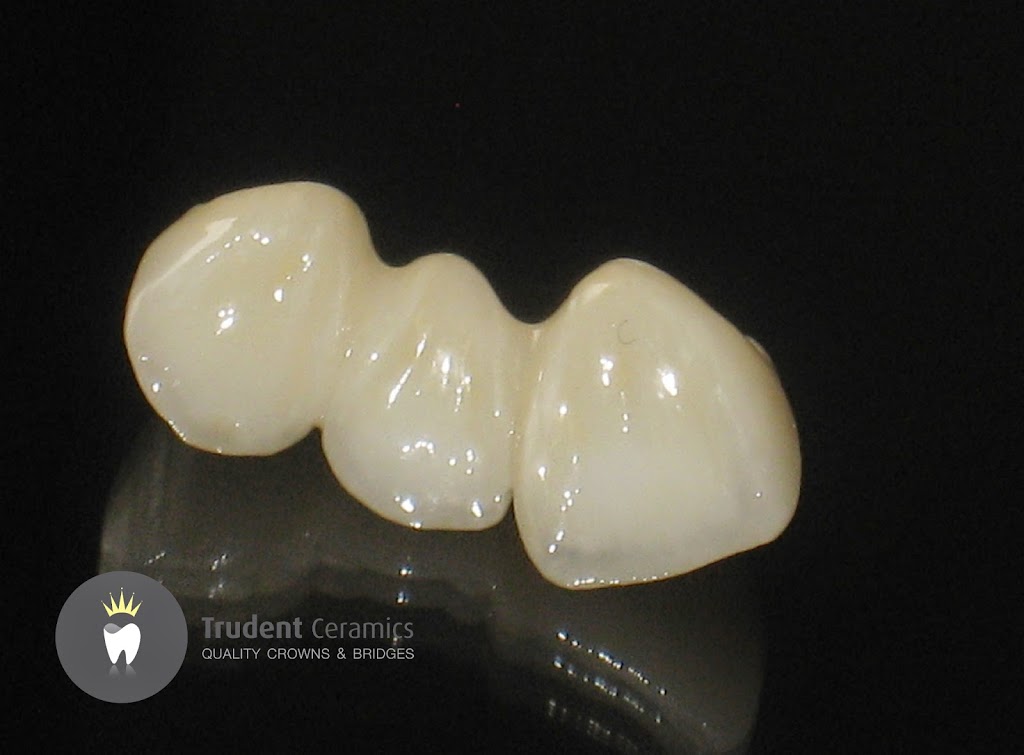 Trudent Ceramics | dentist | Unit 2/33 Mcclares Rd, Vermont VIC 3133, Australia | 0398933584 OR +61 3 9893 3584