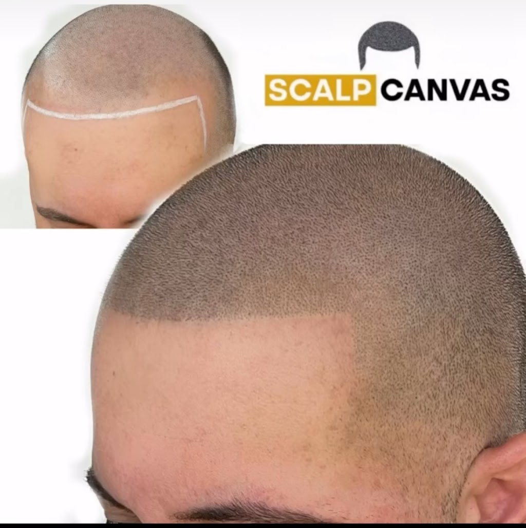 Scalp Canvas - Scalp Micropigmentation Sydney | 1 Inverness Cct, Cecil Hills NSW 2171, Australia | Phone: 0414 400 454