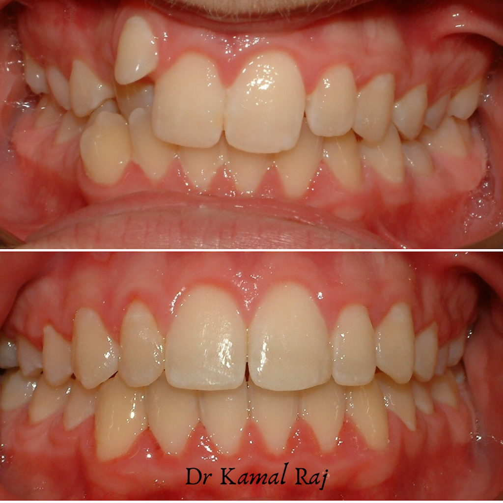 Verve Dental | dentist | 768 Centre Rd, Bentleigh East VIC 3165, Australia | 0395705188 OR +61 3 9570 5188