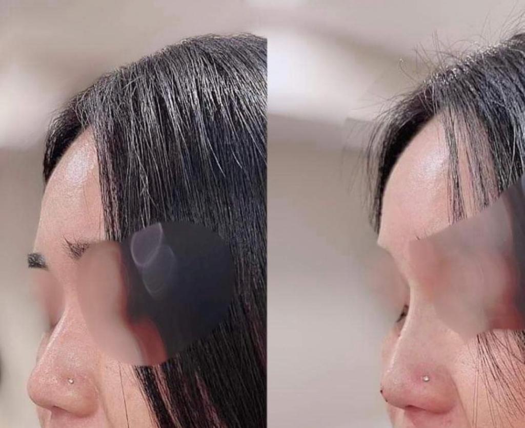 Sydney Cosmetic Clinic | Shop 1/570 New Canterbury Rd, Hurlstone Park NSW 2193, Australia | Phone: 0458 030 177