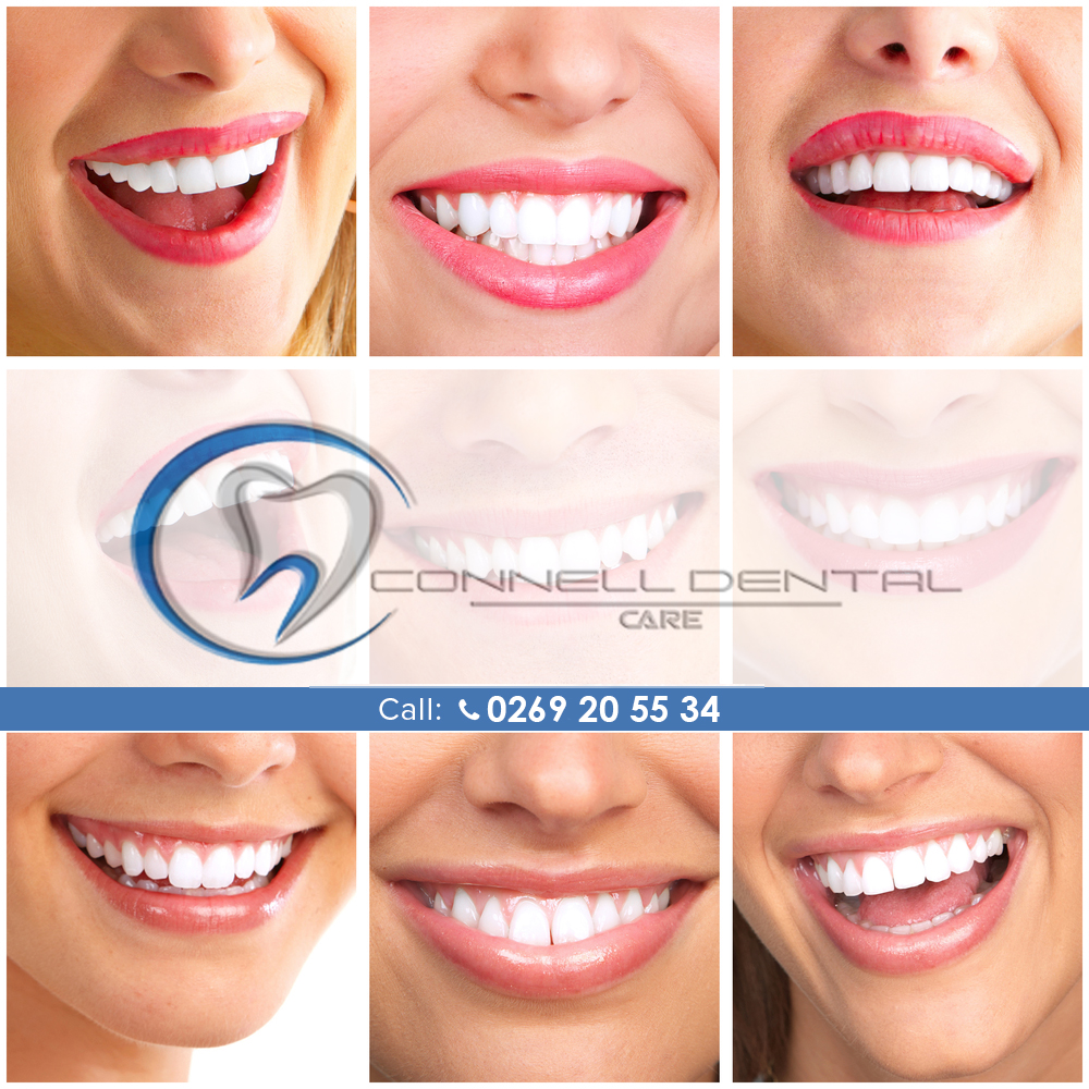 Connell Dental Care | dentist | 85 Green St, Lockhart NSW 2656, Australia | 0269205534 OR +61 2 6920 5534