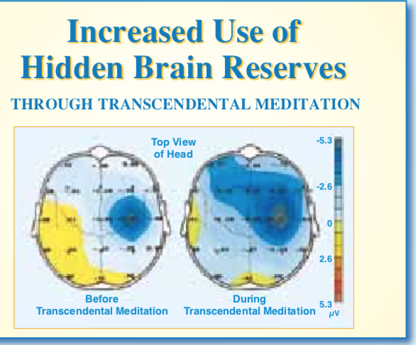 Transcendental Meditation Ringwood | health | 133 Heatherdale Rd, Cnr Canterbury Rd, Vermont VIC 3133, Australia | 0488762577 OR +61 488 762 577