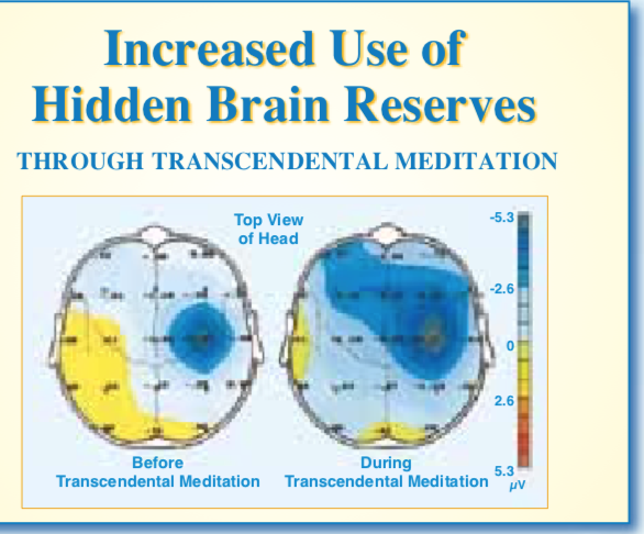 Transcendental Meditation Ringwood | 133 Heatherdale Rd, Cnr Canterbury Rd, Vermont VIC 3133, Australia | Phone: 0488 762 577