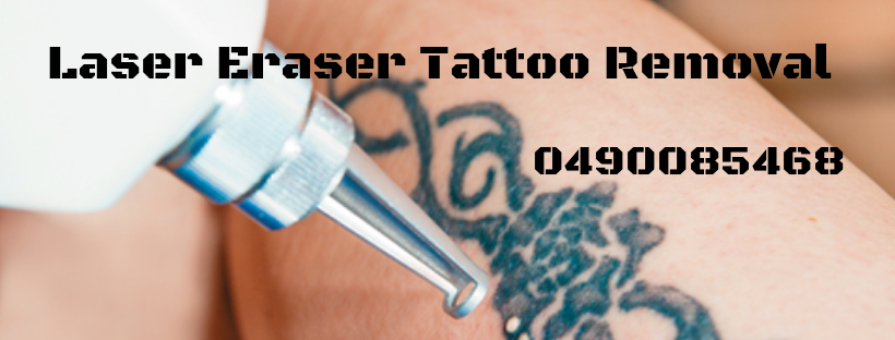 Laser Eraser Tattoo Removal & Beauty | 91 Cobbora Rd, Dubbo NSW 2830, Australia | Phone: 0490 085 468