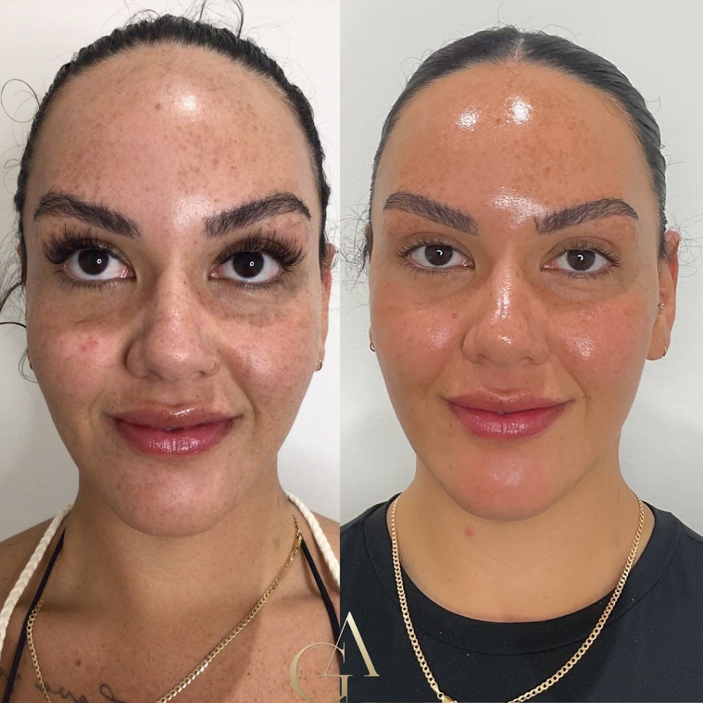 Gorjess Aesthetics | 2/7 Russell St, Corrimal NSW 2518, Australia | Phone: 0401 839 994