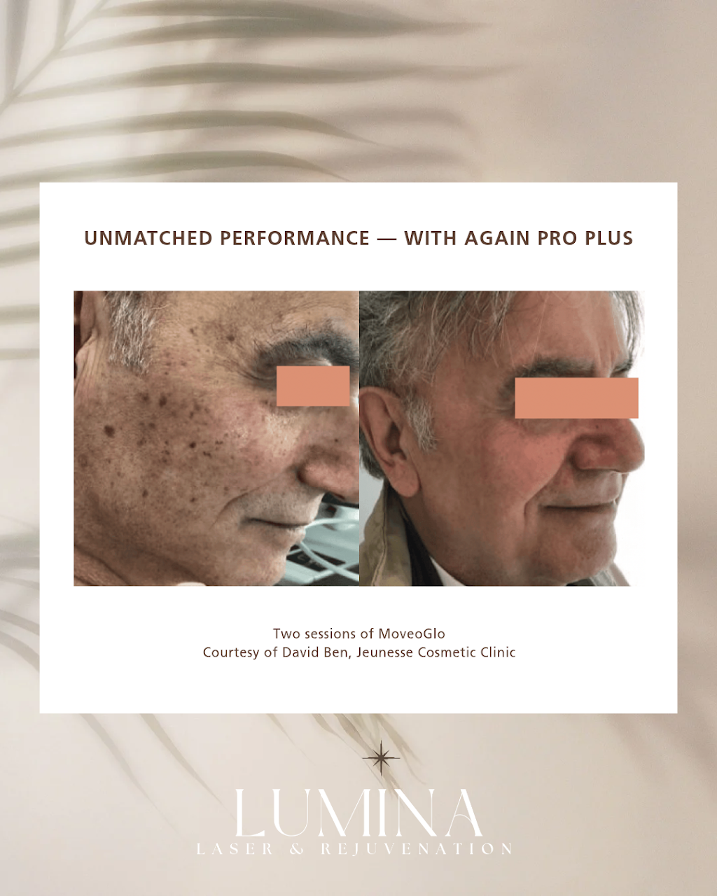 Lumina Laser & Rejuvenation | 40 Bowman St, Richmond NSW 2753, Australia | Phone: 0461 293 621