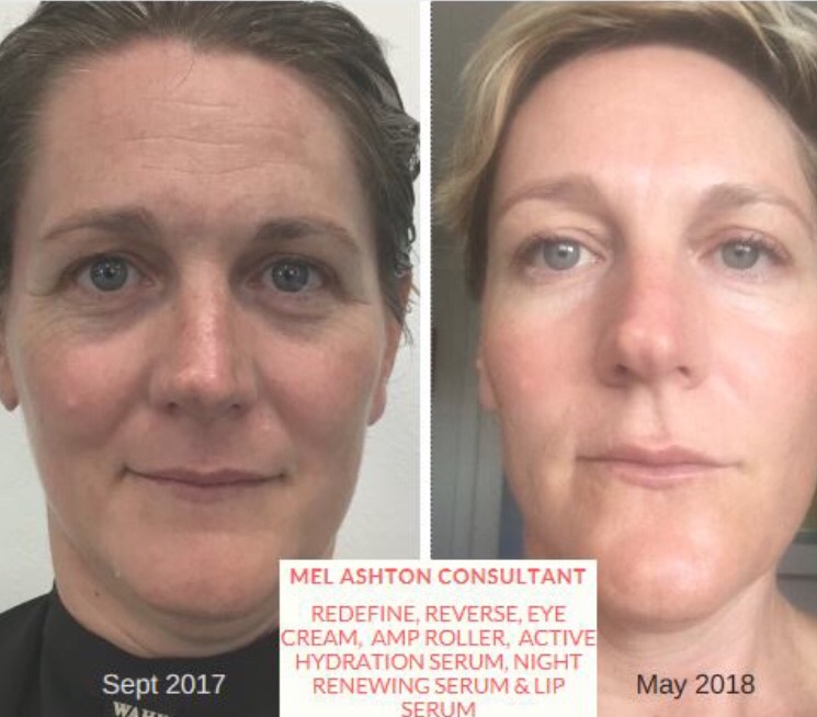 Rodan + Fields Skincare - Mel Ashton | 15 Brisbane Pl, Cromer NSW 2099, Australia | Phone: 0435 730 565