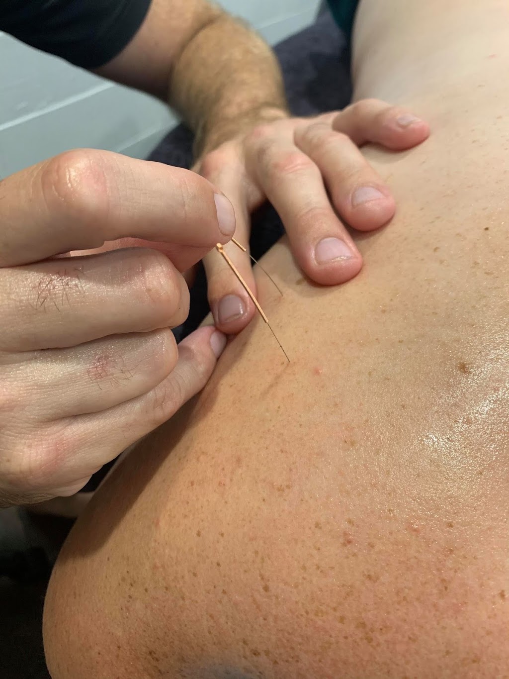 Pin Point Remedial Massage | 22 Clayton Rd, Lammermoor QLD 4703, Australia | Phone: 0406 916 490