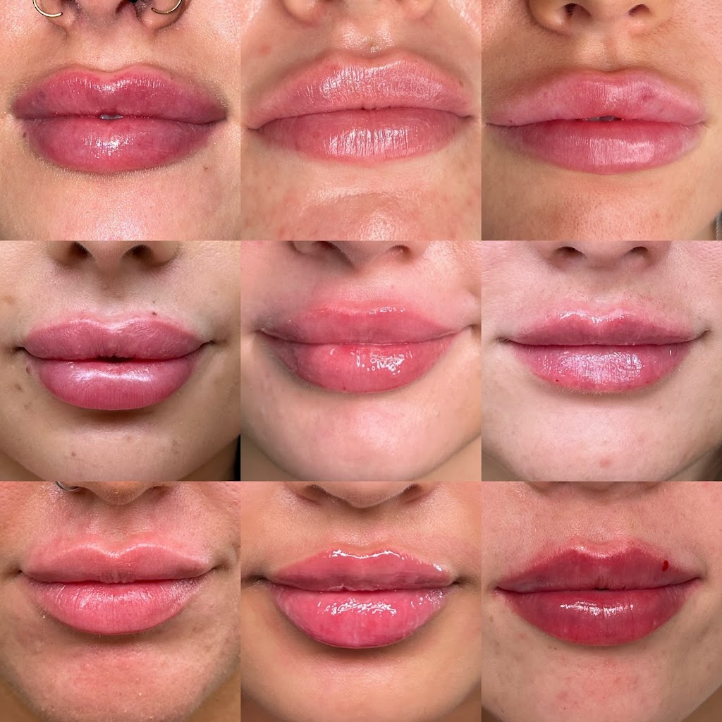 Bare Facial Aesthetics | 13 Harold St, Wendouree VIC 3355, Australia | Phone: 0400 261 308