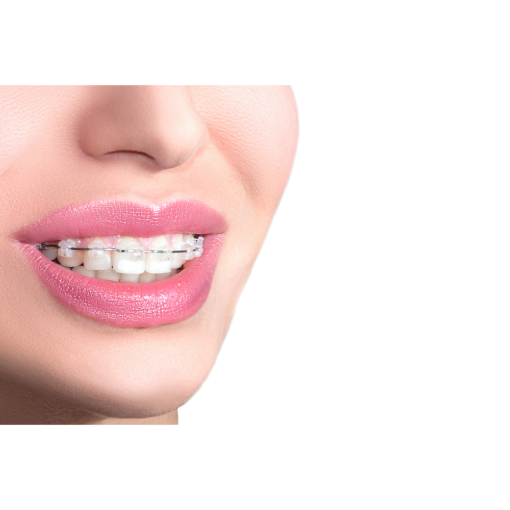 Dental Savers | dentist | 4/111 William Berry Dr, Morayfield QLD 4506, Australia | 0754951888 OR +61 7 5495 1888