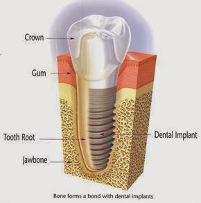 A1 Dental Care | 21 Benjamin Way, Belconnen ACT 2617, Australia | Phone: (02) 6251 9991