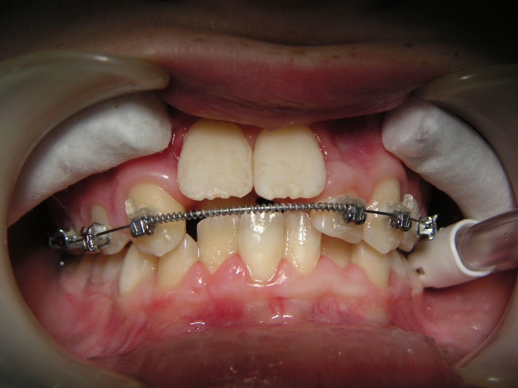 Dental Orthodontic Centre | dentist | 17 Winthrop Dr, Winthrop WA 6150, Australia | 0893108828 OR +61 8 9310 8828