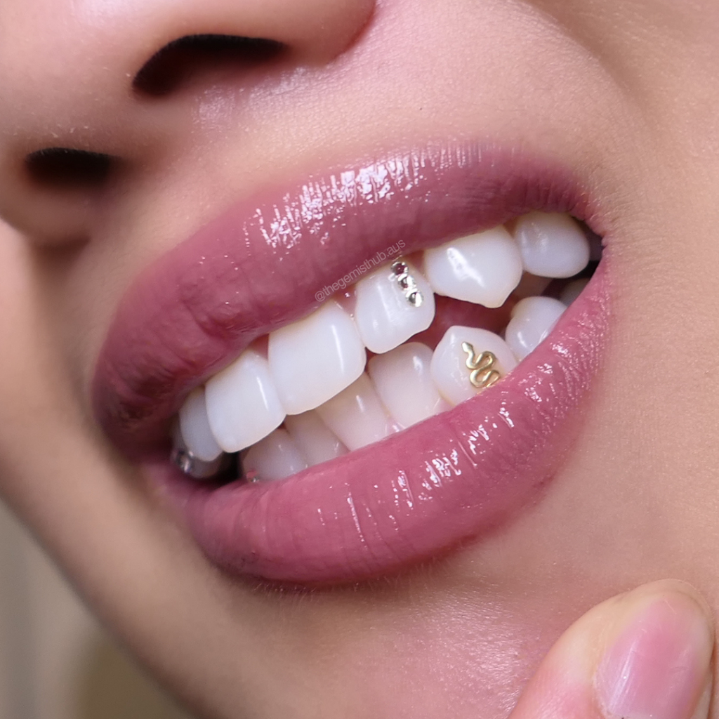The Gemist Hub | Tooth Gems Sydney | Teeth Whitening Sydney | Vale St, Canley Vale NSW 2166, Australia | Phone: 0416 169 211
