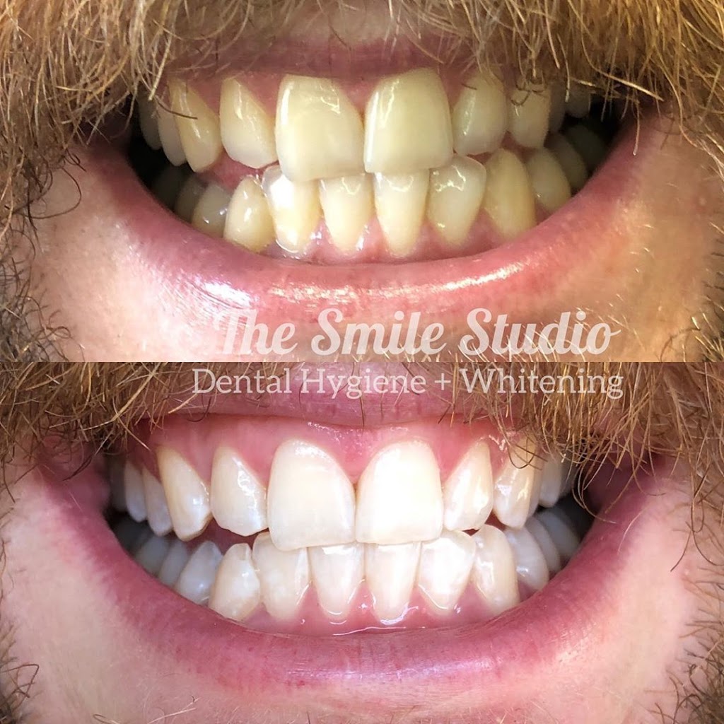 The Smile Studio Dental Hygiene & Whitening | 373 Main St, Bairnsdale VIC 3875, Australia | Phone: 0407 303 232