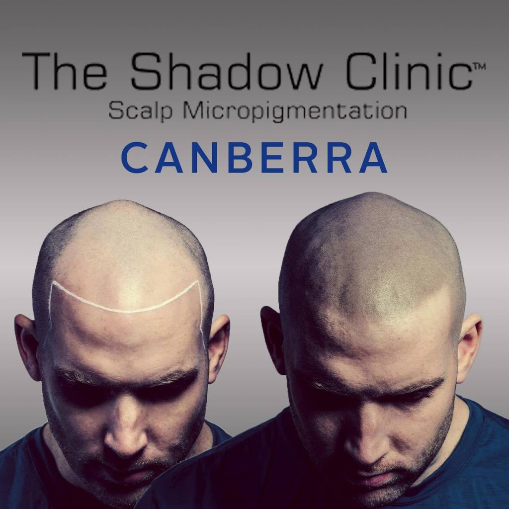 The Shadow Clinic Canberra | hair care | 1C/39 Grimwade St, Mitchell ACT 2911, Australia | 0468364200 OR +61 468 364 200