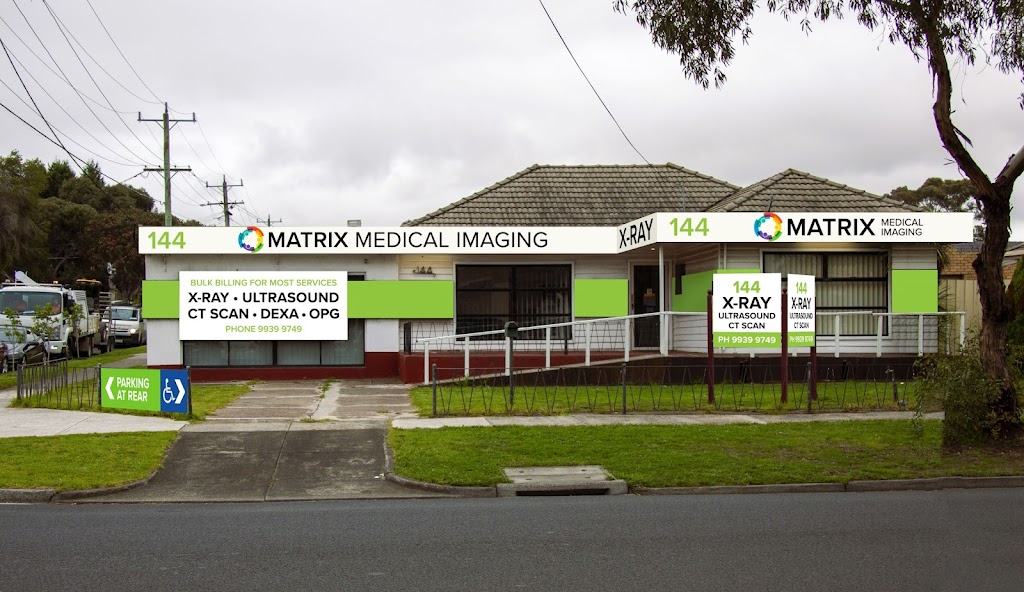 Matrix Medical Imaging Fawkner | 144 Jukes Rd, Fawkner VIC 3060, Australia | Phone: (03) 9939 9749