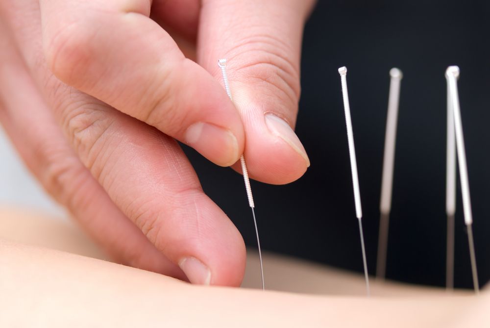 Brigitte Linder Acupuncture & Classical Chinese Medicine | 29 Bayview Ave, Tenby Point VIC 3984, Australia | Phone: 0421 812 691