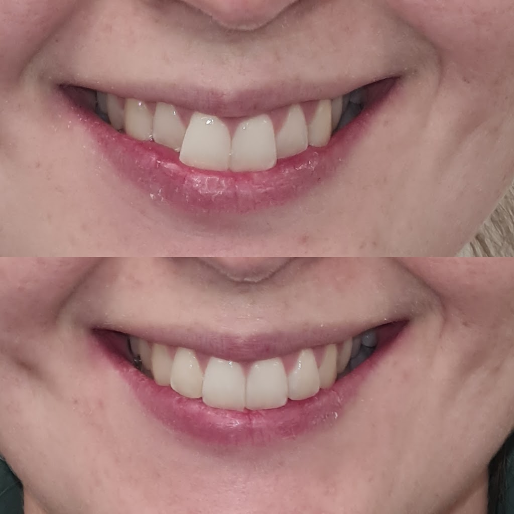 Armstrong Smiles | T01/500 - 540 Torquay Rd, Armstrong Creek VIC 3217, Australia | Phone: (03) 5215 1333
