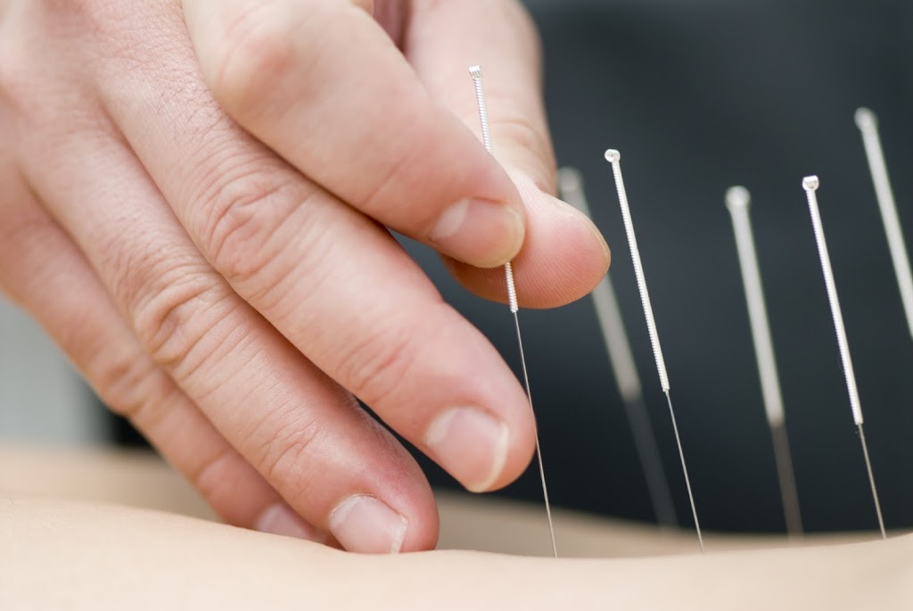 Peel Back Care Clinic - Dry Needling & Remedial Massage | 35 Anstruther Rd, Mandurah WA 6210, Australia | Phone: (08) 9535 2690