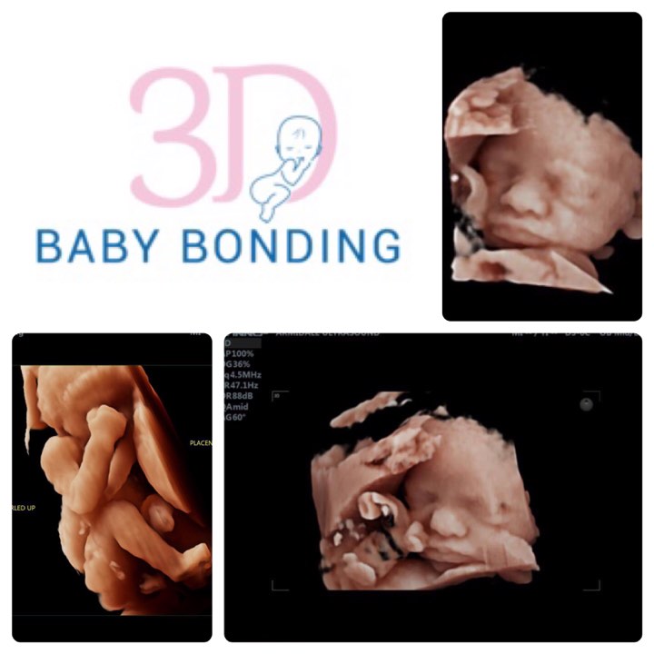 3D Baby Bonding | hospital | 210 a Rusden St, Armidale NSW 2350, Australia | 0457223360 OR +61 457 223 360