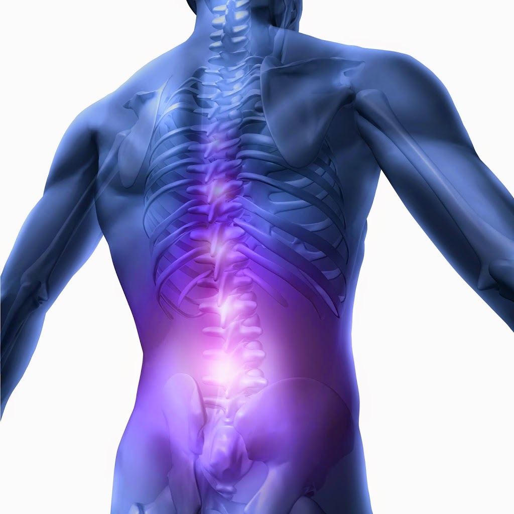 Fix my Spine - Back & Shoulder Treatment | health | 77 Cecil Ave, Castle Hill NSW 2154, Australia | 0286075052 OR +61 2 8607 5052