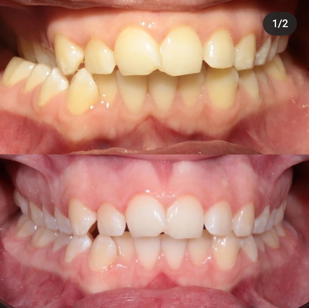 Confident Smile Dental - Dentist Mt Gambier | 10 Wehl St N, Mount Gambier SA 5290, Australia | Phone: (08) 8725 6899