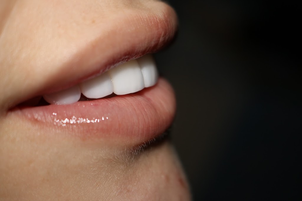 ICONIC SMILES DENTAL | dentist | 183 King George’s Rd, Roselands NSW 2196, Australia | 0283856163 OR +61 2 8385 6163
