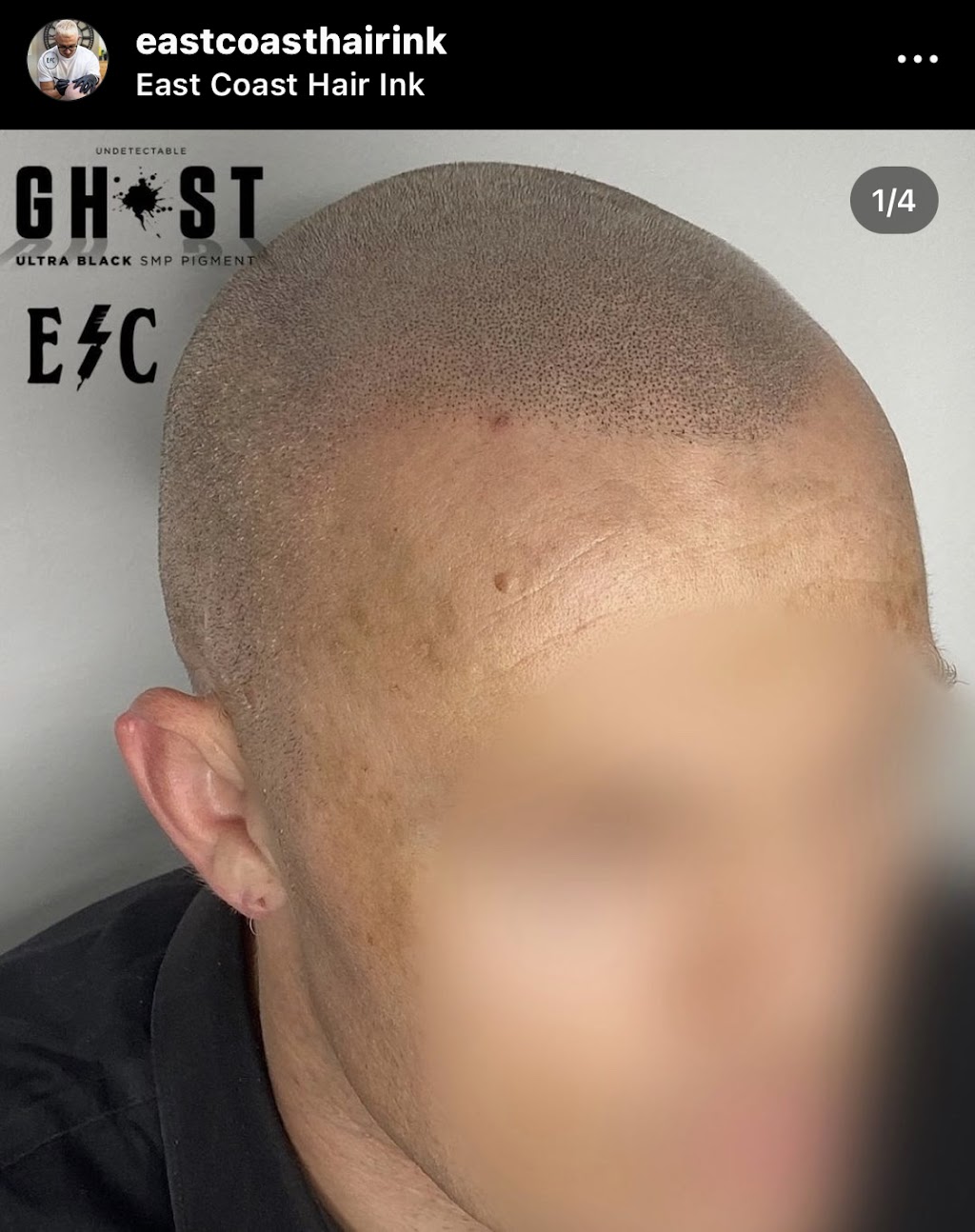 East Coast Hair ink | 1/86 Quambone St, Worongary QLD 4213, Australia | Phone: 0406 739 124