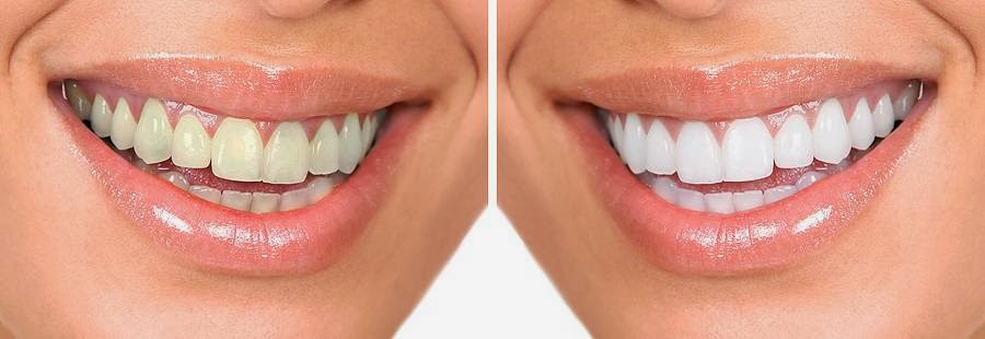 Paradise Smiles Dental Surgery | dentist | 6/8 Halcyon Way, Hope Island QLD 4212, Australia | 0755109999 OR +61 7 5510 9999