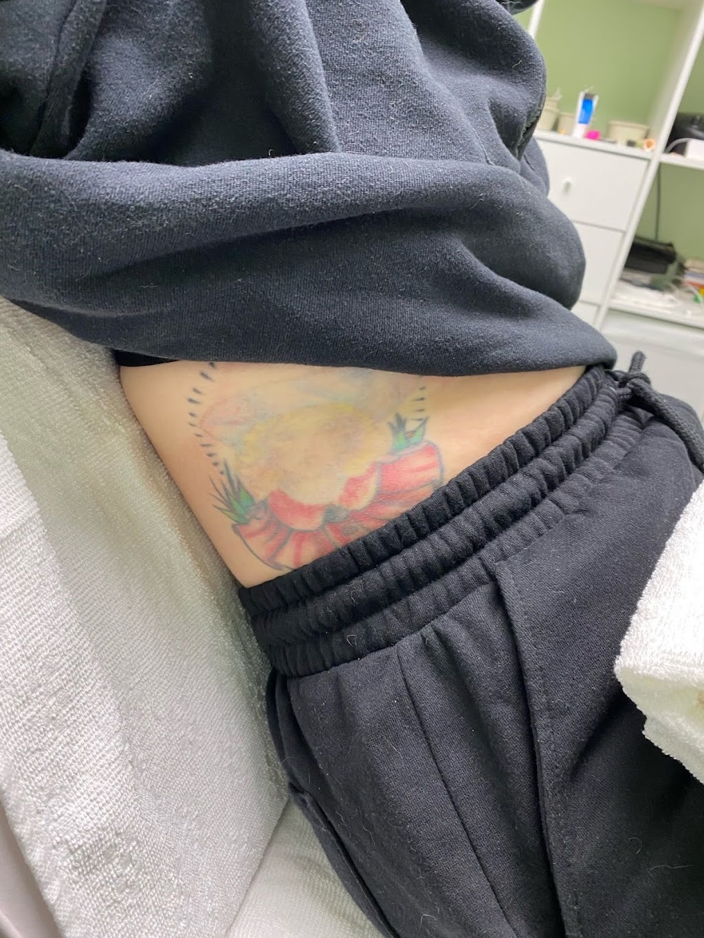 Really Good Tattoo Removal | 47 Clayton St, Sandgate QLD 4017, Australia | Phone: 0413 006 477