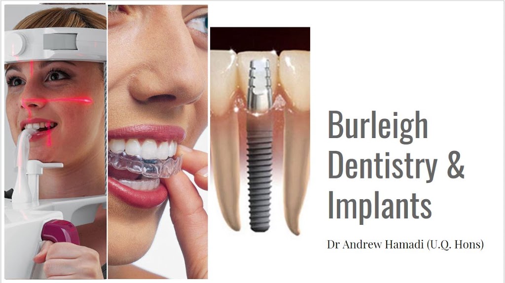 Burleigh Dentistry & Implants | dentist | 13/2 Executive Dr, Burleigh Waters QLD 4220, Australia | 0755936461 OR +61 7 5593 6461