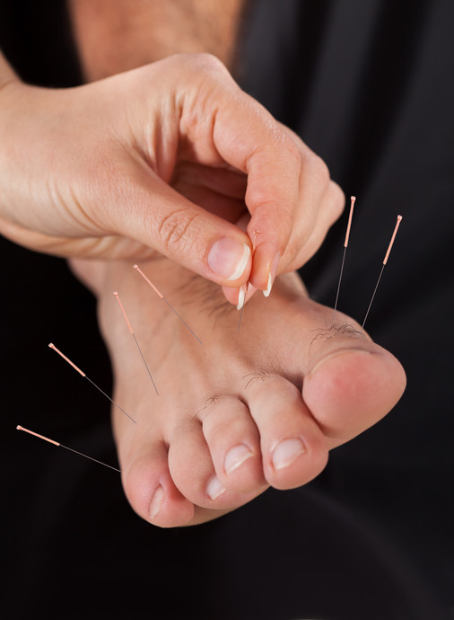 Mansfield Sports Acupuncture | health | 205 Piries-Goughs Bay Rd., (Piries), Mansfield VIC 3722, Australia | 0438815167 OR +61 438 815 167