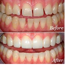 Ornate Dental Clinic | dentist | 259 E Boundary Rd, Bentleigh East VIC 3165, Australia | 0390686027 OR +61 3 9068 6027