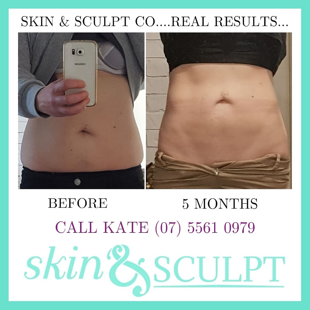 Skin and Sculpt Co | beauty salon | Q Super Centre - Shop B1C Cnr Bermuda &, Markeri St, Mermaid Waters QLD 4218, Australia | 0756610979 OR +61 7 5661 0979