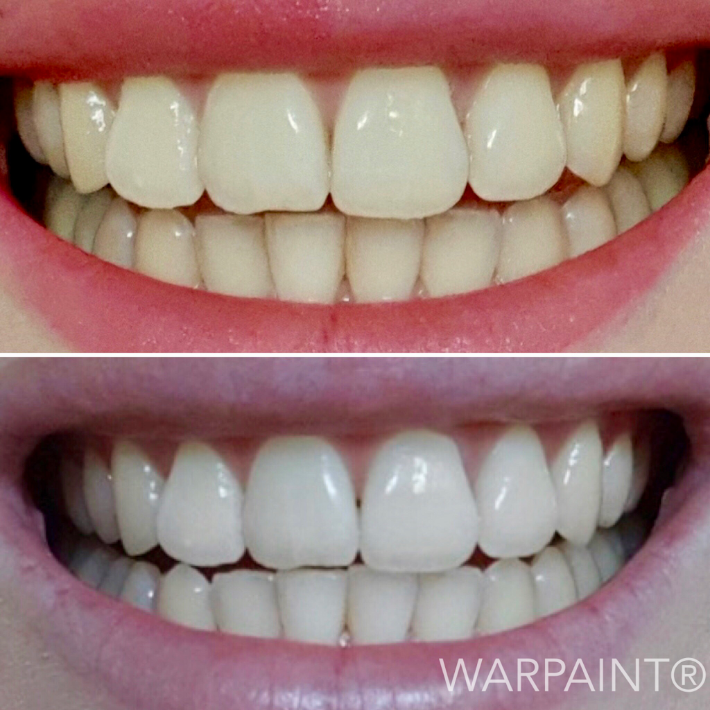 WARPAINT Natural Teeth Whitener | 33 Thornton St, Surfers Paradise QLD 4217, Australia
