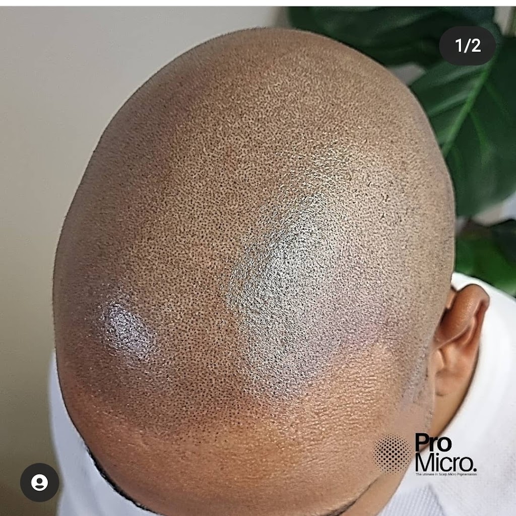 Pro Micro - Scalp Micropigmentation SMP | 23/58 Riverwalk Ave, Robina QLD 4226, Australia | Phone: 0437 778 852