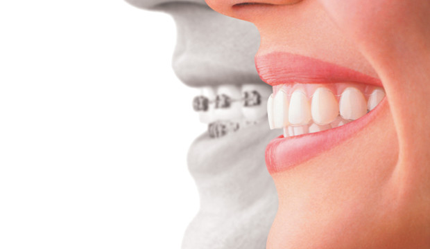 Modern Orthodontics | 1 Leonard St, Burwood VIC 3125, Australia | Phone: 1300 367 678