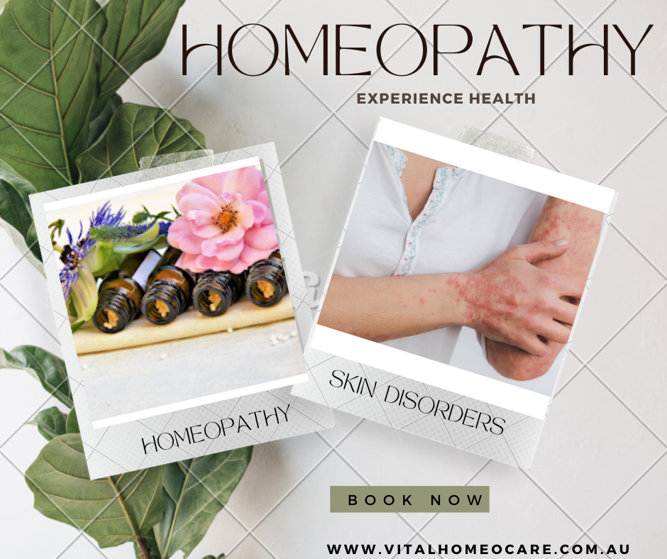Vital Homeo Care - Homeopathy | 49 Pinner St, Upper Mount Gravatt QLD 4122, Australia | Phone: 0431 895 785