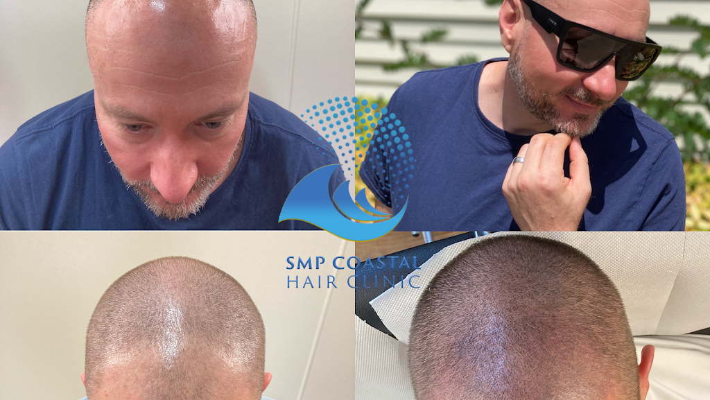 SMP coastal hair clinic | 21 Pacific Hwy, Ourimbah NSW 2250, Australia | Phone: 0439 922 957