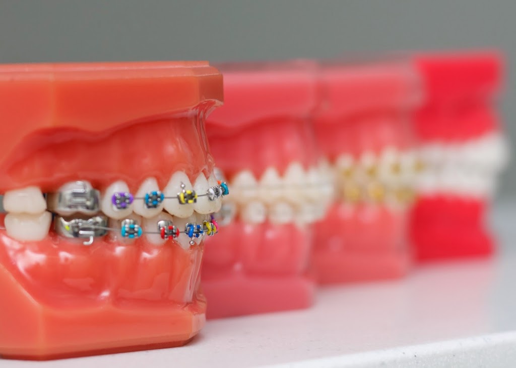 Hunter Valley Orthodontics | 464 The Esplanade, Warners Bay NSW 2282, Australia | Phone: 1800 021 064